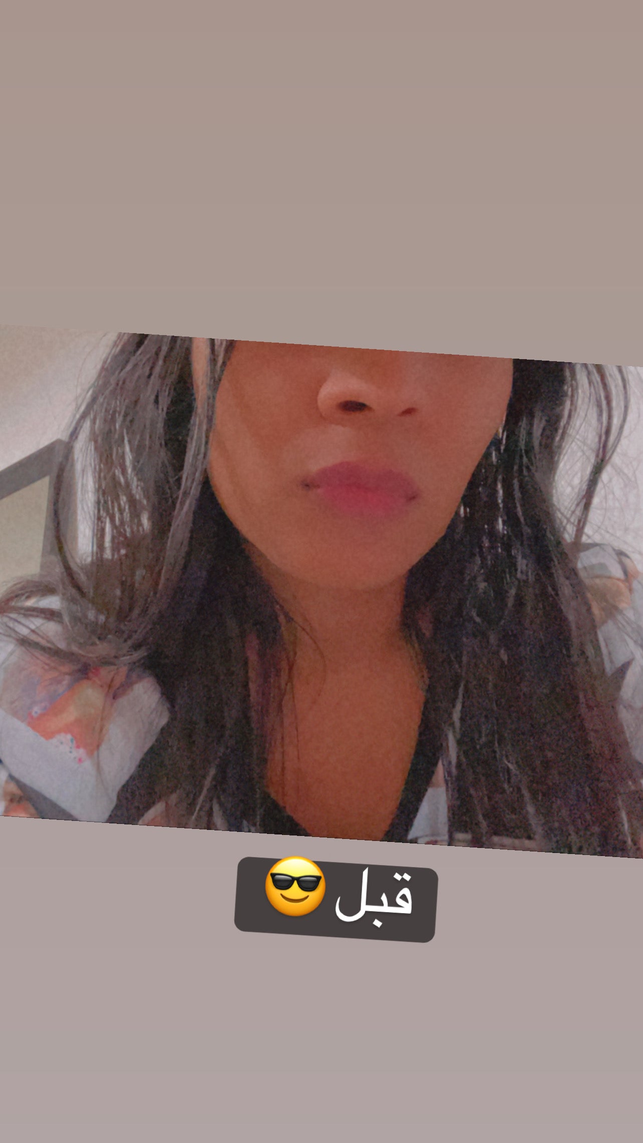 Lip Plumperمضخم شفاه مع زيت الزنجبيل
